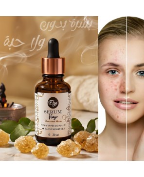 Sérum Visage ELYS  Homme Oliban & Huiles Anti-Acné – 30 ml